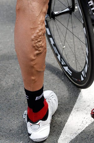 Tour De France Crashes In Pictures Sport The Guardian