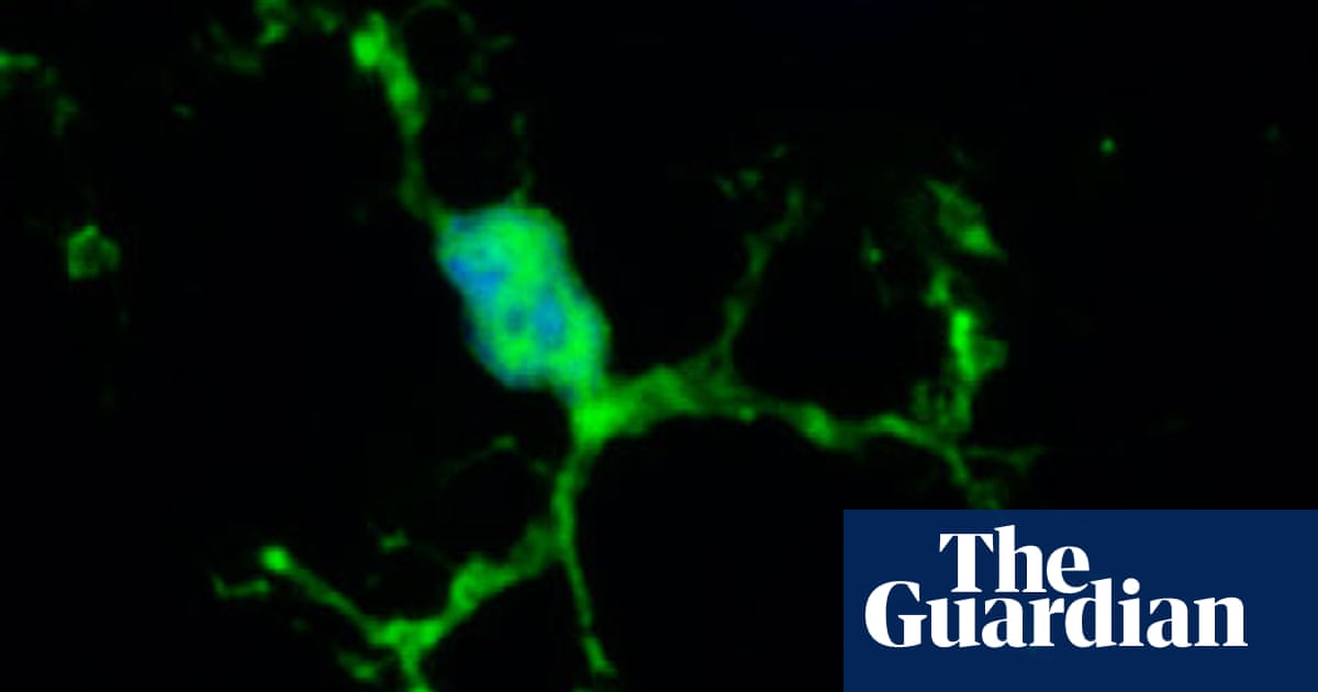 The Brain Treats Unwanted Synapses Like Invading Microbes Neuroscience The Guardian The Brain Treats Unwanted Synapses Like Invading Microbes Neuroscience The Guardian