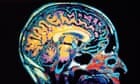 The science behind memory glitches, Psychology
