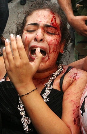 Beirut car Bomb: A wounded woman