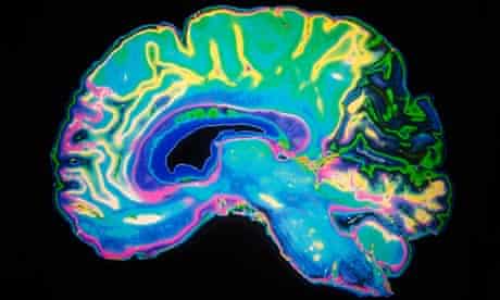 Human brain scan