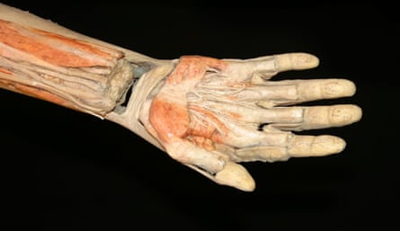 Dissected human hand