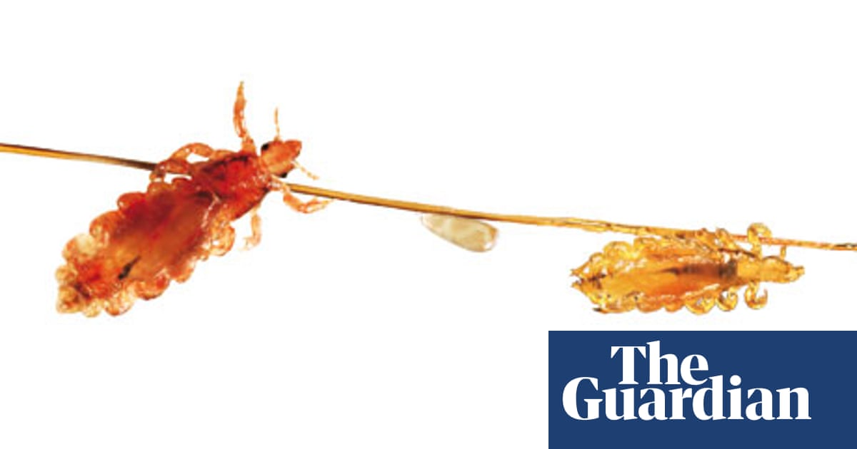 https://i.guim.co.uk/img/static/sys-images/Guardian/Pix/pictures/2012/11/1/1351769488506/Head-lice-and-an-egg-on-h-007.jpg?width=1200&height=630&quality=85&auto=format&fit=crop&overlay-align=bottom%2Cleft&overlay-width=100p&overlay-base64=L2ltZy9zdGF0aWMvb3ZlcmxheXMvdGctZGVmYXVsdC5wbmc&enable=upscale&s=466e5023c775ff6b65fd107da5734841
