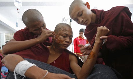 A severely burnt Buddhist monk, Burma