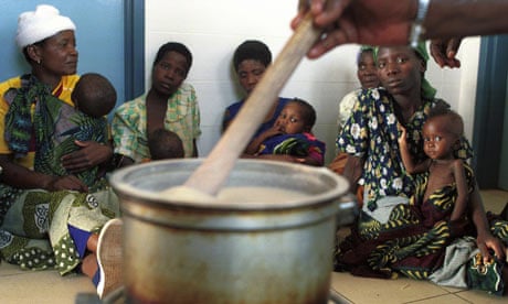 Malnourished children in Malawi