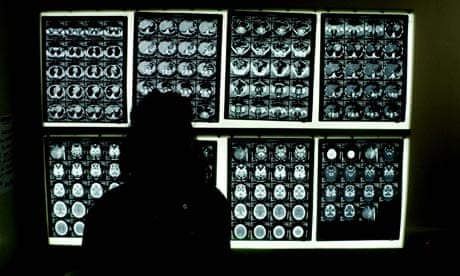 A substantial majority of Royal College of Radiologists members called for NHS reforms to be axed