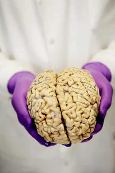 A-brain-ready-for-dissect-001.jpg?width=480&quality=45&auto=format&fit=max&dpr=2&s=738fec598ebbf8359779ec850436b802