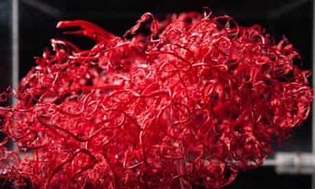 Wellcome Collection: blood vessels of the brain