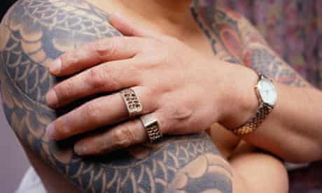 Former Yakuza Member with Prosthetic Fingers