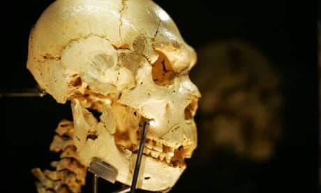 A skull from one of the bodies found in a pit in Spain