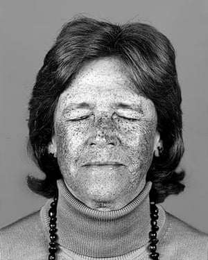  Big Picture: Ultraviolet: Portraits shot using ultraviolet photography to show signs of ageing