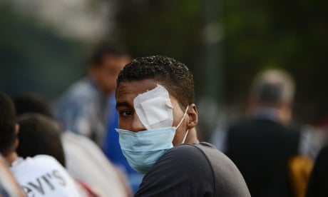 An injured Egyptian protester looks on during clashes with riot police near the US embassy in Cairo.
