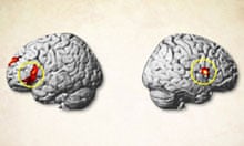 The regions of the brain to which TMS was administered