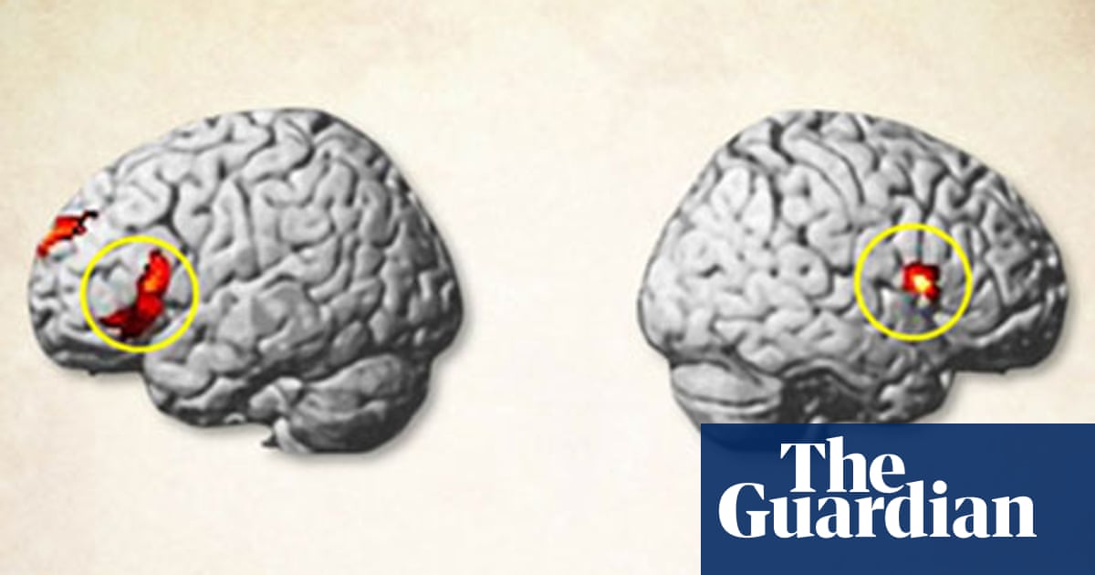 Brain-controlling Magnets How Do They Work Science The Guardian Brain-controlling Magnets How Do They Work Science The Guardian