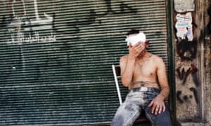 A Syrian man wounded by shelling sits on a chair outside a closed shop in the Al-Muasalat area in Aleppo.