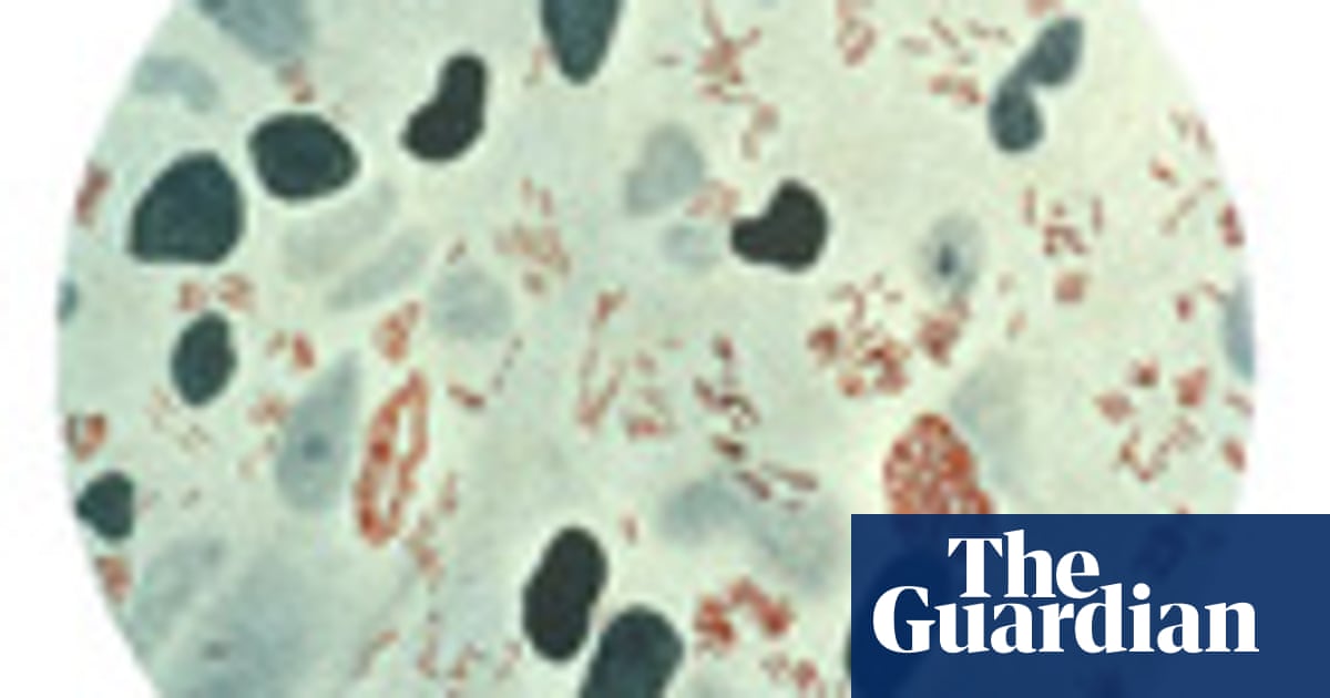 Leprosy Spreads By Reprogramming Nerve Cells Into Migratory Stem Cells Mo Costandi Science The Guardian