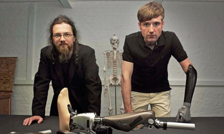 Bionic man: Richard Walker and Bertolt Meyer with iWalk BiOM Ankles