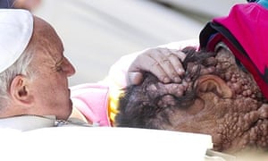 Pope Francis holds a sick person in Saint Peter's Square at the end of his General Audience in Vatic