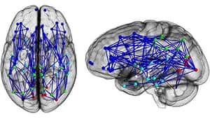 Men women brains