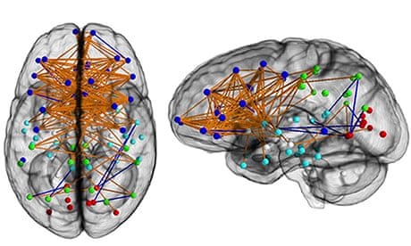 https://i.guim.co.uk/img/static/sys-images/Guardian/Pix/pictures/2013/12/2/1386013189069/Female-brain-008.jpg?w=620&q=55&auto=format&usm=12&fit=max&s=5b04f08a073fecfff1fa29b86834ae2c