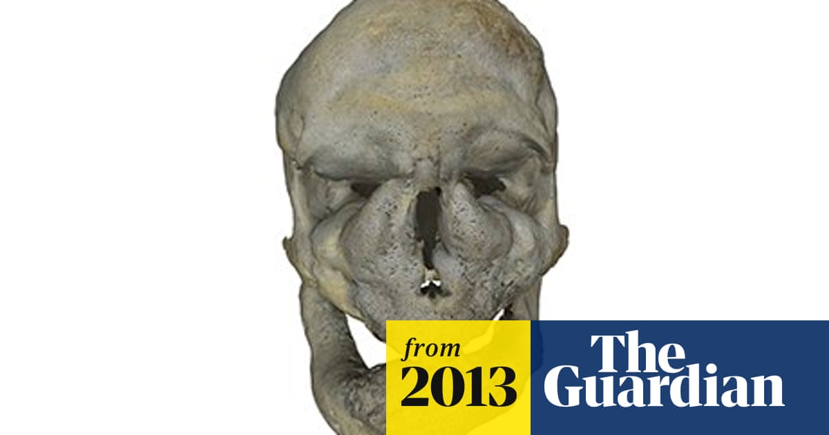 Online in 3D: the 'grotesque beauty' of medieval Britons' diseased bones