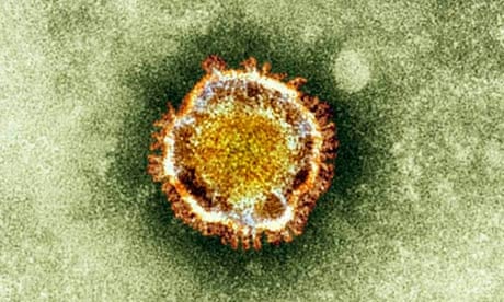 Sars coronavirus