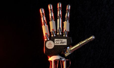 Paralysed bionic breakthrough aritifical limbs
