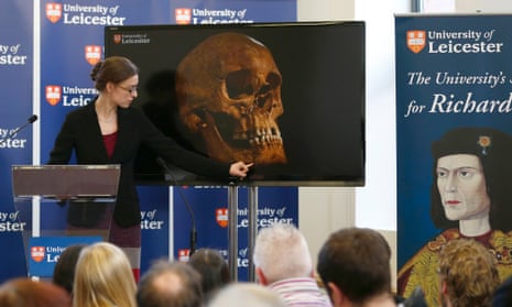 Jo Appleby shows the press one of the injuries to Richard III's skull, on 4 February 2013.