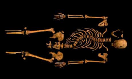 The complete skeleton showing the curve of the spine of Richard III