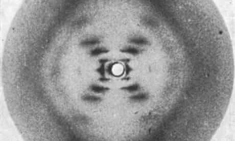 X-ray diffraction pattern of DNA