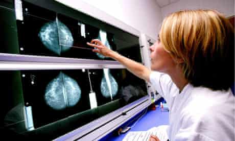 Breast cancer rates increase among younger women