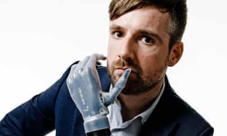 Bertolt Meyer who has an i-limb bionic hand