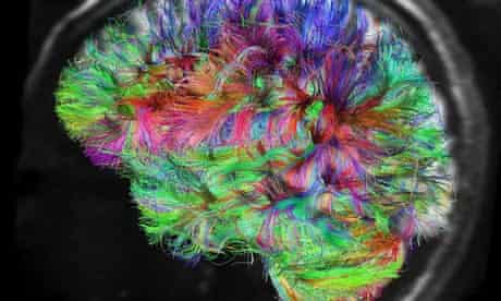 Human Behaviour Is It All In The Brain Or The Mind Neuroscience The Guardian