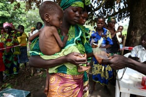 MSF in CAR: Mobile clinic for checking for malaria and malnutrition 