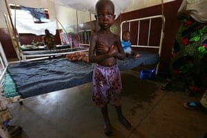 MSF in CAR: Epaphrasse is being treated for severe malnutrition at Bossangoa hospital