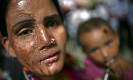 A survivor of an acid attack attends a rally with her child in Dhaka