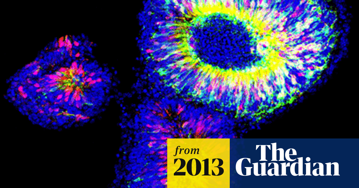 Embryonic stem cells could help restore sight to blind