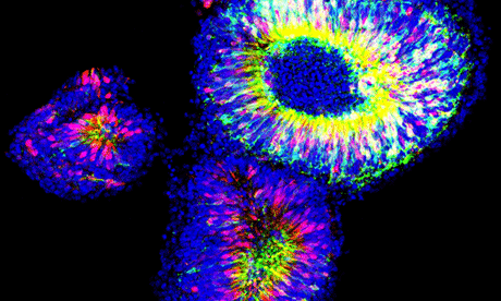 Retinas grown from mouse embryonic stem cells