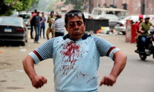 An injured protester reacts during clashes between residents and Mohamed Morsi supporters outside Cairo University.