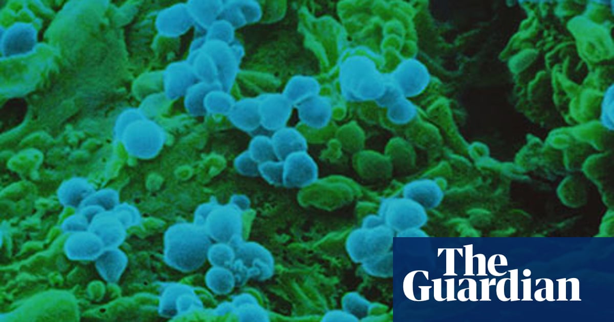 Measles Outbreak Australia 2025