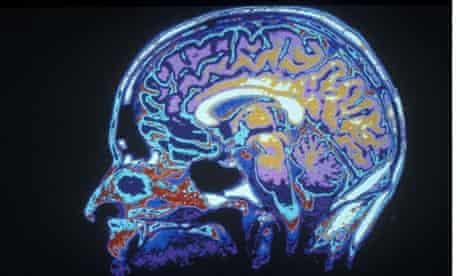 Why Do We Make Mistakes Blame Your Brain The Original Autocorrector Yuka Igarashi The Guardian Why Do We Make Mistakes Blame Your Brain The Original Autocorrector Yuka Igarashi The Guardian