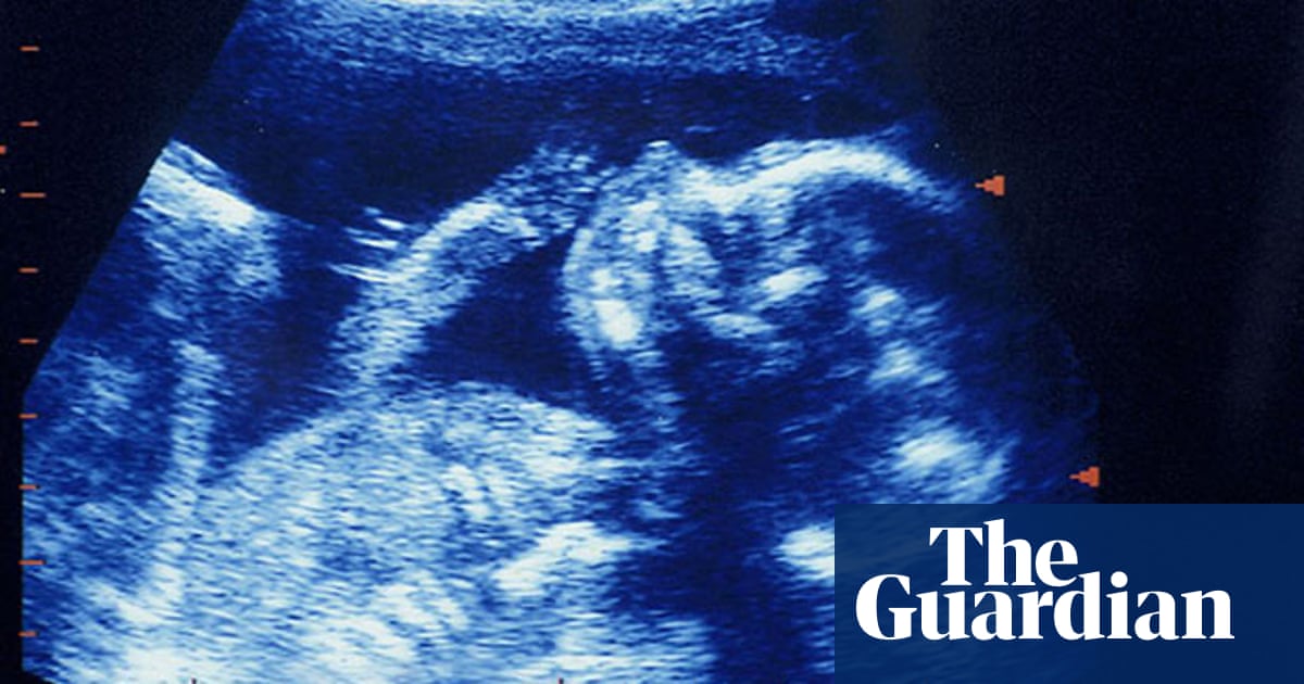 Zoe S Law Which Put Legal Abortion In Nsw At Risk All But