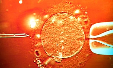 IVF treatment sperm being injected into human egg