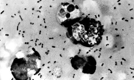 Bubonic plague bacteria