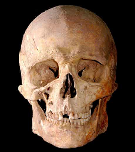 Skull-of-mesolithic-hunte-001.jpg?w=620&