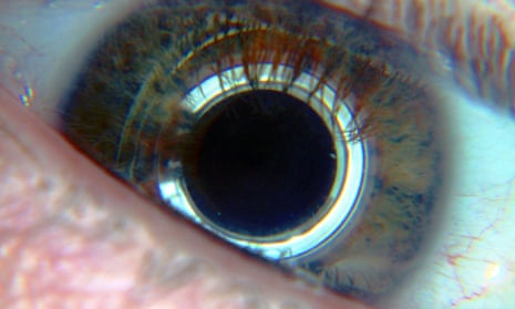 cyborg eye