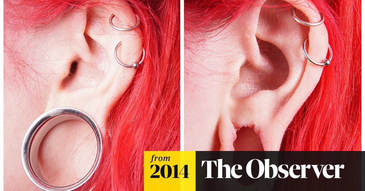 Big increase in surgery to mend 'flesh tunnel' earlobes | Cosmetic surgery | The Guardian Big increase in surgery to mend 'flesh tunnel' earlobes | Cosmetic surgery | The Guardian