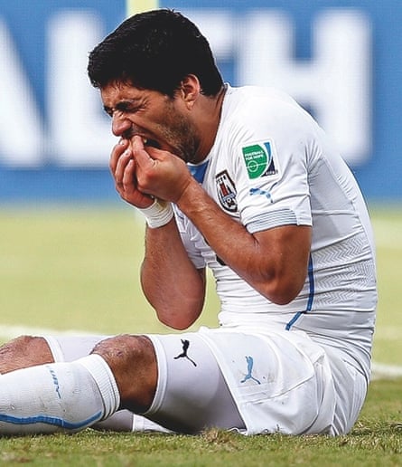 Luis Suárez holding his teeth after biting Giorgio Chiellini at this year’s World Cup