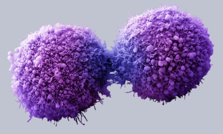 Google is developing a cancer and heart attack-detecting pill