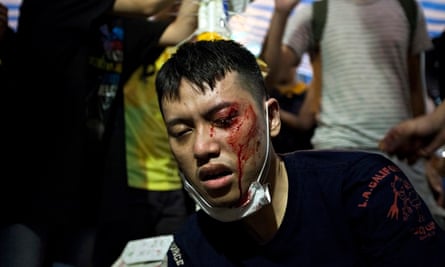 An injured pro-democracy protester receives medical attention in Hong Kong